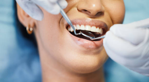 Best Urgent Care for Lost Fillings or Crowns in Howards Grove, WI