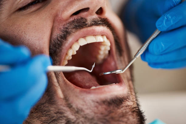 Best Emergency Treatment for Dental Infections or Abscesses in Howards Grove, WI