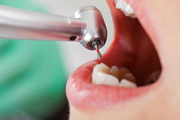 Best Emergency Dental Care for Broken or Chipped Teeth in Howards Grove, WI